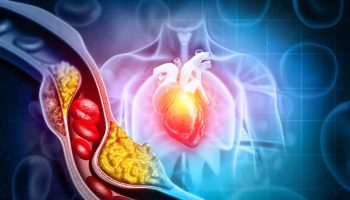 Prevención de enfermedades cardiovasculares